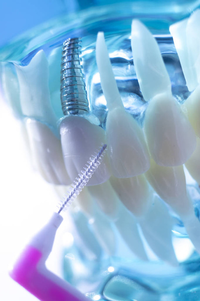 Inter dental teeth cleaning brush healthy floss action between each tooth to remove plaque. - Photo, Image