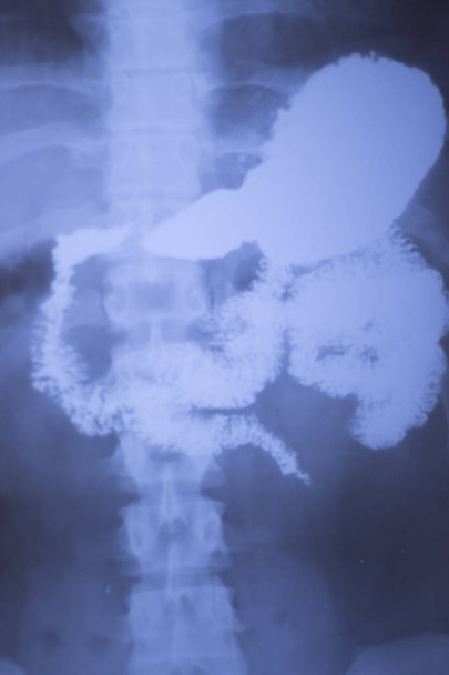 Медична лікарня рентгенівського випромінювання спини біль хребет і стегна травматологія сканування також показує шлунок і органи
. - Фото, зображення