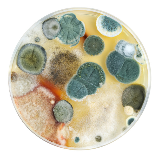 Placa Petri con molde
 - Foto, Imagen