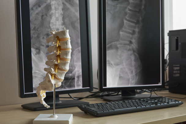Modèle artificiel de colonne lombaire humaine sur la table avec moniteur d'affichage des rayons X de colonne lombaire
 - Photo, image