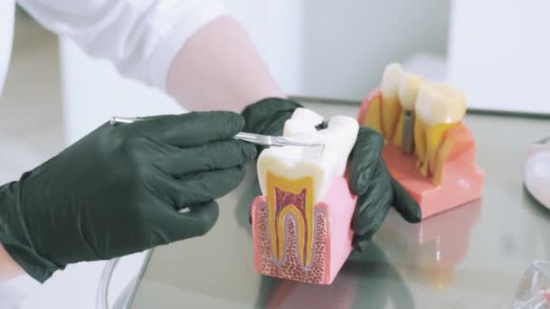 close view of the dentist in medical sterile gloves shows a dummy of human cheeks healthy and spoiled, using a pointed probe showing parts of healthy and aching teeth. Concept of dentistry, dentistry - Imágenes, Vídeo