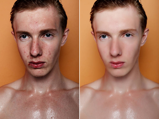 health, people, youth and beauty concept - Before and after cosmetic operation. Young man portrait. Before and after cosmetic or plastic procedure, anti-age therapy, removal of acne, retouching - 写真・画像