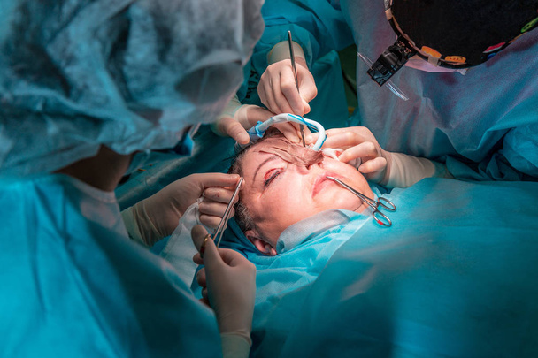 Πλαστική χειρουργική επέμβαση στο χειρουργείο - Φωτογραφία, εικόνα