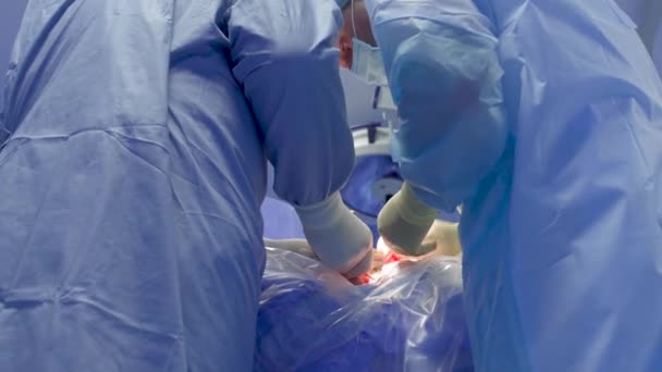 Surgeons make operation - Felvétel, videó