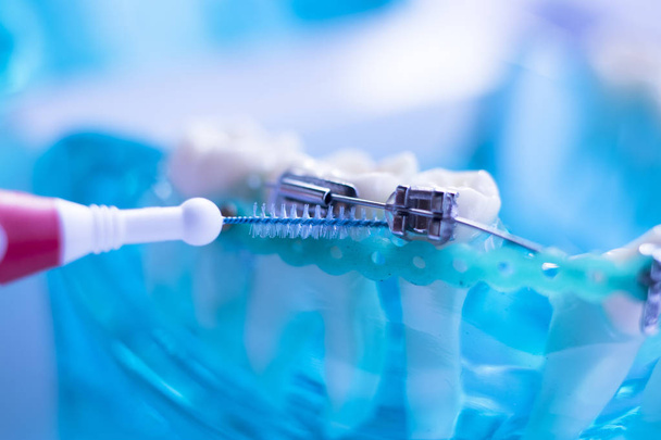 Inter zębów dentystycznych czyszczenia pędzla zdrowe floss działań między każdego zęba z nawiasy klamrowe korekcyjnych. - Zdjęcie, obraz