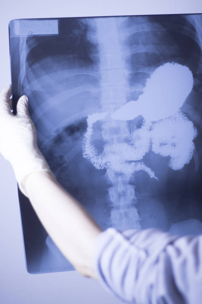 Raio-X hospitalar médico dor nas costas coluna vertebral e quadris traumatologia varredura também mostrando estômago e órgãos
. - Foto, Imagem