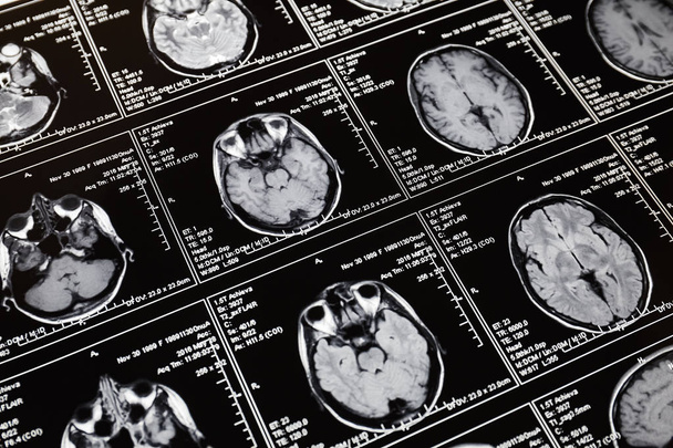 Magnetic resonance scan of the brain. MRI head scan. - Fotó, kép