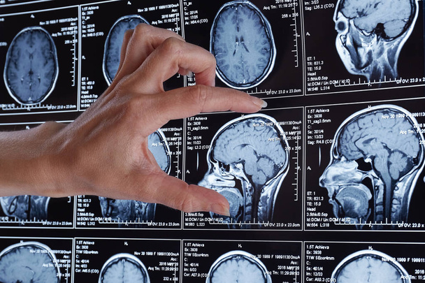 Balayage par résonance magnétique du cerveau. Analyse de la tête IRM
. - Photo, image