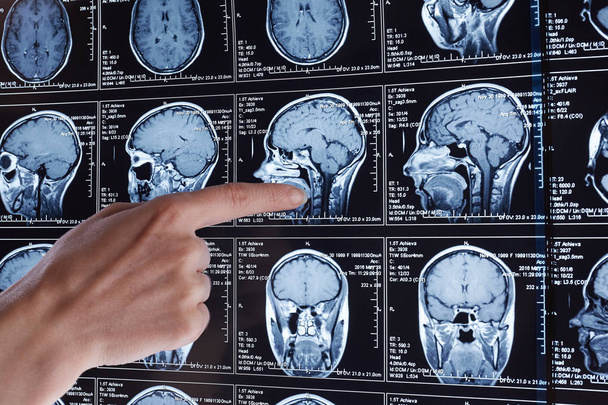 Magnetische resonantie scan van de hersenen. MRI-scan hoofd. - Foto, afbeelding