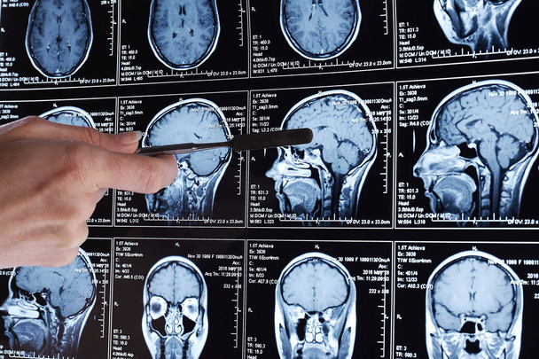 Magnetic resonance scan of the brain. MRI head scan. - Photo, image
