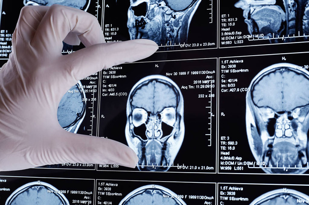 Магнитно-резонансное сканирование мозга. МРТ головы
. - Фото, изображение