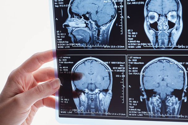 Mágneses rezonancia vizsgálat az agy. Fej MRI-vizsgálat. - Fotó, kép