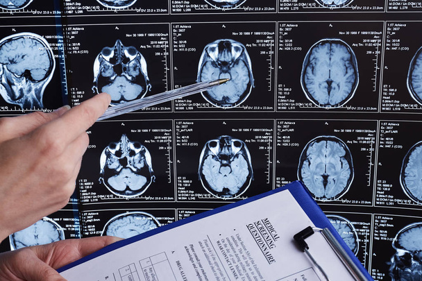 Balayage par résonance magnétique du cerveau. Analyse de la tête IRM
. - Photo, image