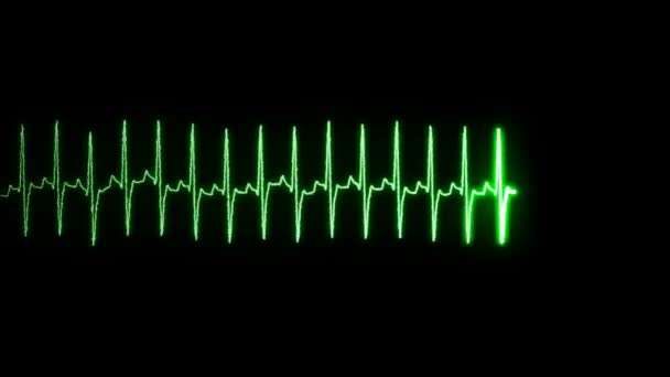 Heartbeat/puls signaal op het scherm. - Video