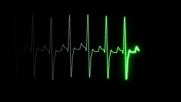 Heartbeat/puls signaal op het scherm. - Video