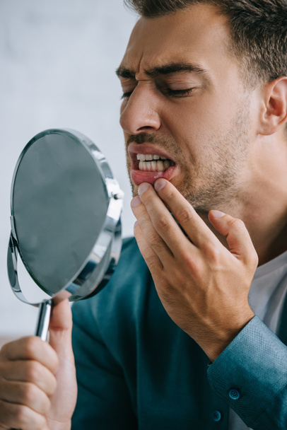 fiatal férfi nézett tükörbe fogfájás  - Fotó, kép