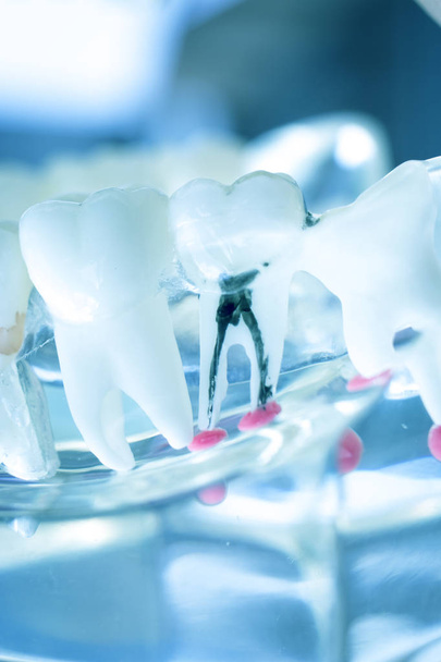 Οδοντιατρική δόντια οδοντίατρος διδασκαλία μοντέλου προβολή κάθε δόντι και τα ούλα για τους ασθενείς και τους μαθητές. - Φωτογραφία, εικόνα
