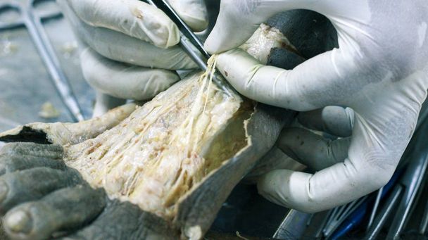 Anatómiai boncolás egy holttest mutató olló szikével és csipesszel vágás bőr lábfej dorsum a fékszárny tanulságos fontos struktúrák artériák erek idegek - Fotó, kép