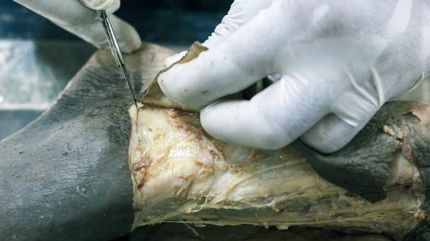 Anatomie dissection d'un cadavre montrant le dos du pied à l'aide de ciseaux à scalpel et de pinces coupant le rabat de la peau révélant des structures importantes artères veines nerfs
 - Photo, image