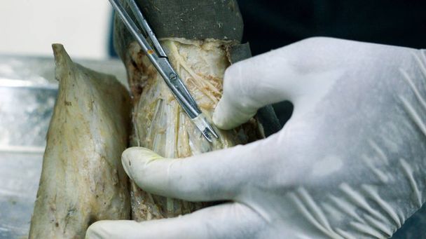 Anatomy dissection of a cadaver showing dorsum of foot using scalpel scissors and forceps cutting skin flap revealing important structures arteries veins nerves - Photo, Image