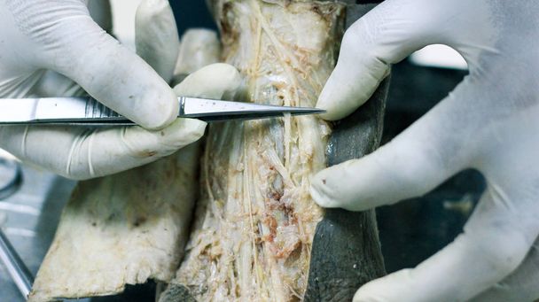 Anatomia rozwarstwienie cadaver Wyświetlono grzbietu stopy za pomocą skalpela nożyczki i kleszcze do cięcia skóry klapy ujawniając ważnych struktur tętnic żył nerwy - Zdjęcie, obraz