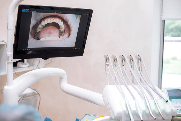 монитор в стоматологии. стоматологический кабинет
 - Фото, изображение