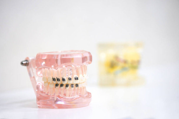 Zähneputzen mit Zahnspange. Demonstrationsmodell der Zähne - Foto, Bild