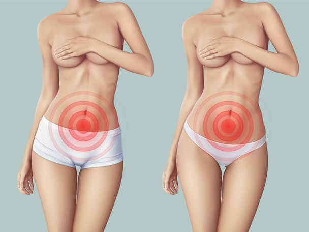 スリムな女性が腹痛に苦しみます。スリムな女性の体とシンボルを使用することができます痛みの体上の任意の場所での痛みのいくつかの種類を示します。現実的なベクトル図 - ベクター画像