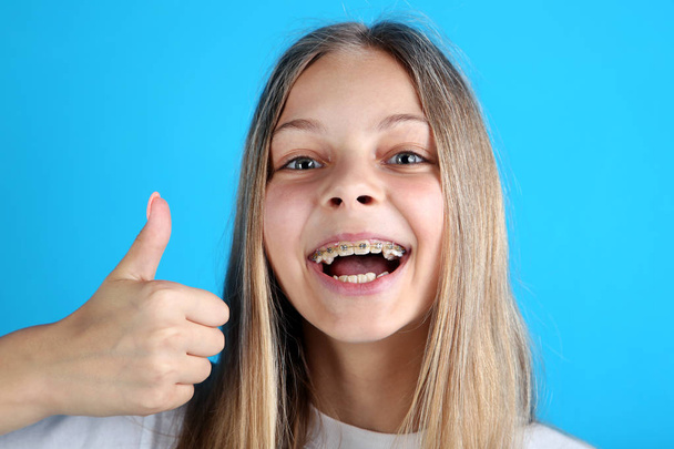 Young smiling girl with dental braces looking at camera and showing thumb up on blue background - Foto, Imagen