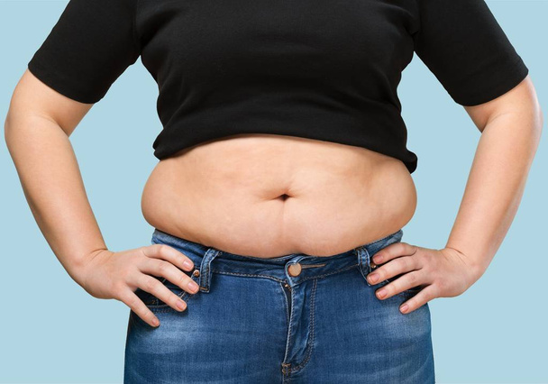 close-up view of Woman with fat belly - Foto, imagen