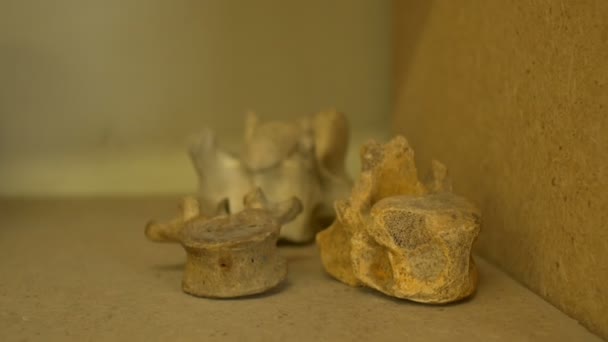 Velho corpo humano ossos da medula espinhal expostos em um laboratório de anatomia
. - Filmagem, Vídeo