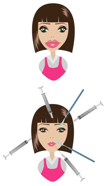 Expert beautician injecting Botulinum toxin in female face. Woman in beauty salon or plastic surgery clinic. - Vector, Image