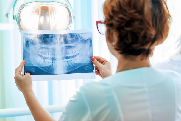 Стоматолог осматривает ортопантомограмму в руках
 - Фото, изображение