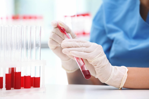 Scientist working with blood sample at table in laboratory - Zdjęcie, obraz