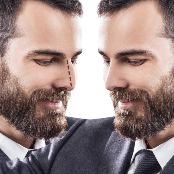 Visage masculin avant et après chirurgie esthétique du nez
. - Photo, image