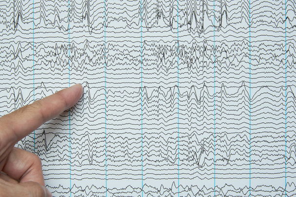 Dedo índice que señala la imagen de las ondas cerebrales humanas por electroencefalografía o EEG
  - Foto, imagen