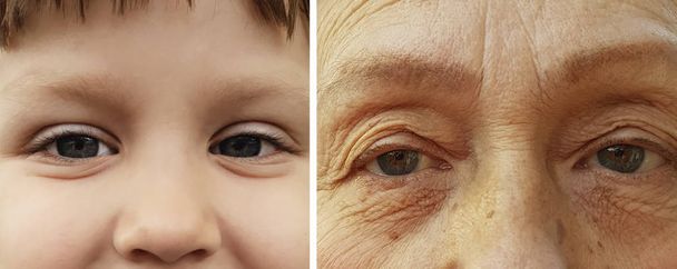 глаза молодой и старой женщины
 - Фото, изображение