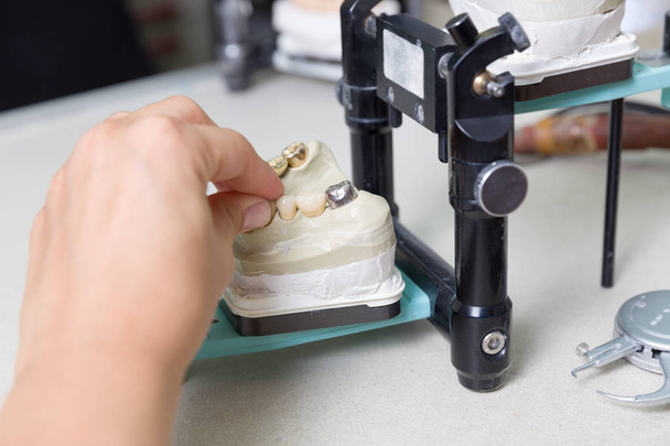 työskennellä proteesi satula keinotekoinen hampaiden hammaslaboratoriossa
 - Valokuva, kuva