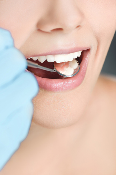 Μερική άποψη του οδοντιάτρου με οδοντικός καθρέφτης έλεγχος γυναικεία δόντια - Φωτογραφία, εικόνα