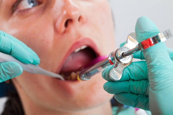 Close up picture of female patient at the dentist office receiving dental anesthesia before caries treatment - Valokuva, kuva