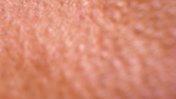 Emberi bőr-elemzés - Felvétel, videó