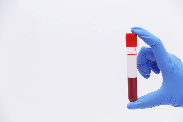 Scientist holding test tube with blood sample against light background. Space for text - 写真・画像