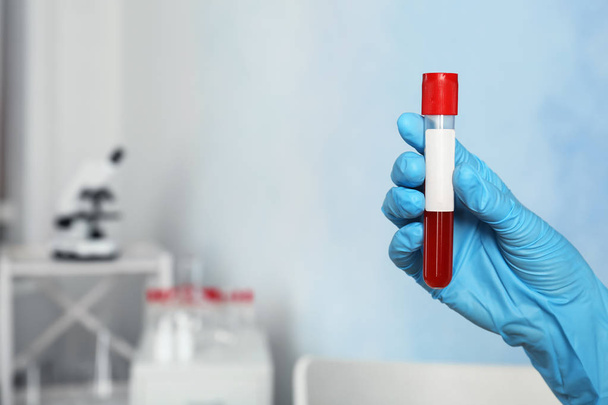 Doctor holding glass tube with blood sample indoors. Allergy test - Photo, image