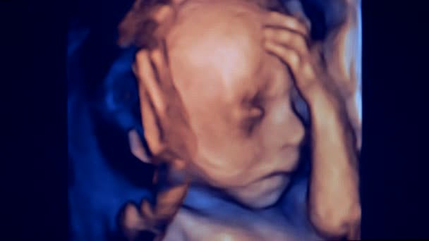 Monitor ultrasónico que representa a un bebé nonato. Bebé moviéndose durante un ultrasonido
. - Metraje, vídeo