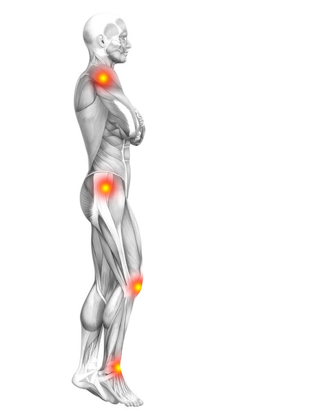 Conceptuele menselijke spier anatomie met rode en gele hotspot ontsteking of articulaire gewrichtspijn voor gezondheidszorg therapie of sport concepten. 3D Illustratie man artritis of bot osteoporose ziekte - Foto, afbeelding