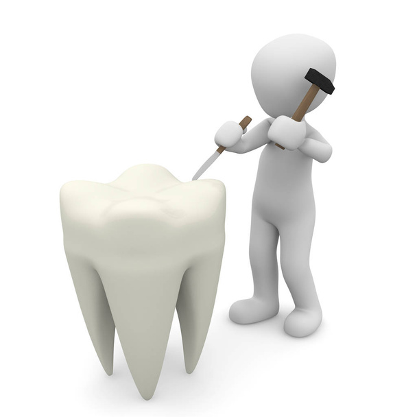  remoção de tártaro no dentista
 - Foto, Imagem