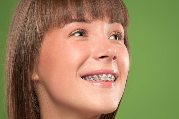 Krásná mladá žena s zuby rovnátka - Fotografie, Obrázek