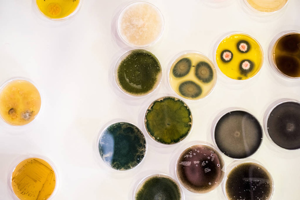 Κουλτούρα των βακτηρίων σε τρυβλίο Petri - Φωτογραφία, εικόνα