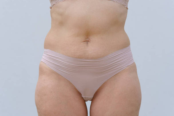 Torso di una donna in mutandina con grasso intorno alla vita in un primo piano ritagliato tronco vista su bianco
 - Foto, immagini