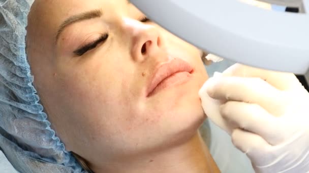 Cosmetologue fait une piqûre beuaty peau pour une femme d'âge moyen avec aiguille de canule. Procédure de lifting du visage. Biorevitalisation et mésothérapie. 4k
 - Séquence, vidéo